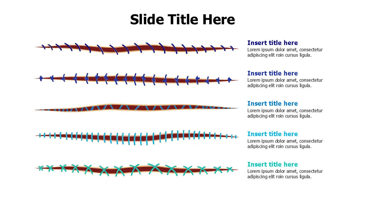 5 types of surgical stitches infographic